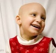 bald child with cancer